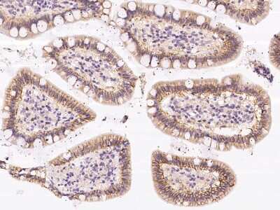 Immunohistochemistry: GPR150 Antibody [NBP3-06009] - Immunochemical staining of human GPR150 in human kidney with rabbit polyclonal antibody at 1:500 dilution, formalin-fixed paraffin embedded sections.