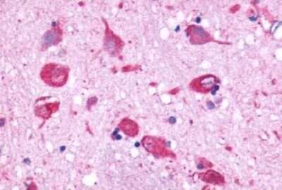 Immunohistochemistry-Paraffin: GPR150 Antibody [NLS3345] - Anti-GPR150 antibody IHC of human brain, neurons and glia. Immunohistochemistry of formalin-fixed, paraffin-embedded tissue after heat-induced antigen retrieval.