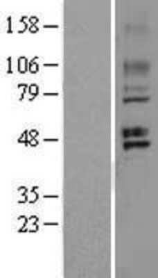 Western Blot: GPR150 Overexpression Lysate (Adult Normal) [NBL1-11256] Left-Empty vector transfected control cell lysate (HEK293 cell lysate); Right -Over-expression Lysate for GPR150.