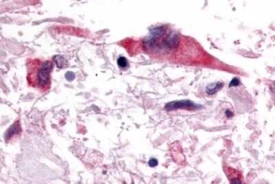 Immunohistochemistry-Paraffin: GPR153 Antibody [NLS3141] - Anti-PGR1 / GPR153 antibody IHC of human Brain, Glioblastoma. Immunohistochemistry of formalin-fixed, paraffin-embedded tissue after heat-induced antigen retrieval.