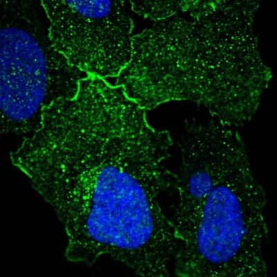 Immunocytochemistry/ Immunofluorescence GPR156 Antibody - BSA Free