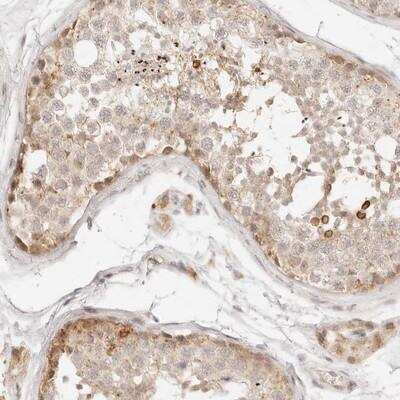 Immunohistochemistry-Paraffin: GPR156 Antibody [NBP1-83402] - Staining of human testis shows moderate cytoplasmic positivity in basal cells.