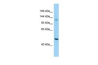Western Blot: GPR158 Antibody [NBP2-82932] - Host: Rabbit. Target Name: GPR158. Sample Type: Jurkat Whole Cell lysates. Antibody Dilution: 1.0ug/ml