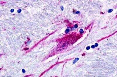 Immunohistochemistry-Paraffin: GPR160 Antibody [NLS542] - Brain, caudate neuron