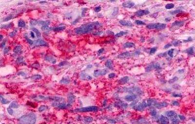 Immunohistochemistry-Paraffin GPR160 Antibody - BSA Free