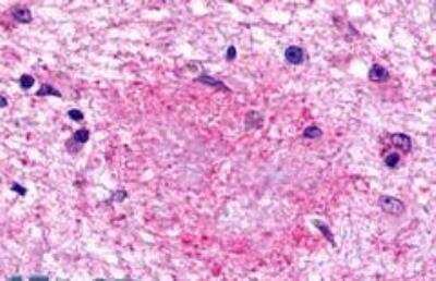 Immunohistochemistry-Paraffin GPR160 Antibody - BSA Free