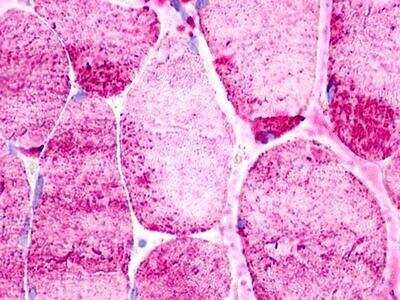 Immunohistochemistry-Paraffin: GPR160 Antibody [NLS619] - Skeletal muscle