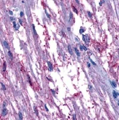 Immunohistochemistry-Paraffin: GPR161 Antibody [NLS333] - IHC analysis of Brain, Pituitary using NLS333 at 3 ug/ ml.