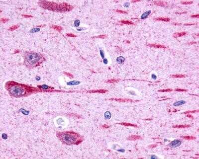 Immunohistochemistry-Paraffin: GPR162 Antibody [NLS1692] - Analysis of anti-GPR162 antibody with human brain, neurons and glia.
