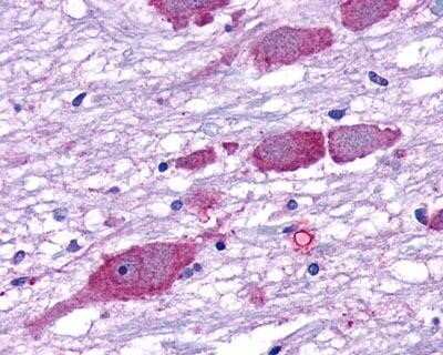 Immunohistochemistry-Paraffin: GPR162 Antibody [NLS1695] - IHC staining of human brain, neurons and glia.