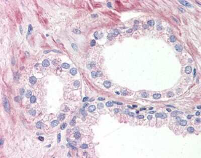 Immunohistochemistry-Paraffin: GPR164 Antibody [NBP2-29390] - Analysis of anti-OR51E1 antibody with human prostate at 15-20 ug/ml.