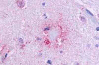 Immunohistochemistry-Paraffin GPR164 Antibody - BSA Free