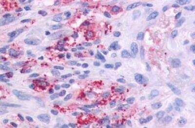 Immunohistochemistry-Paraffin GPR164 Antibody - BSA Free