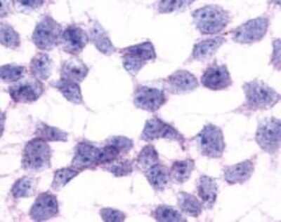 Immunocytochemistry/ Immunofluorescence GPR17 Antibody - BSA Free