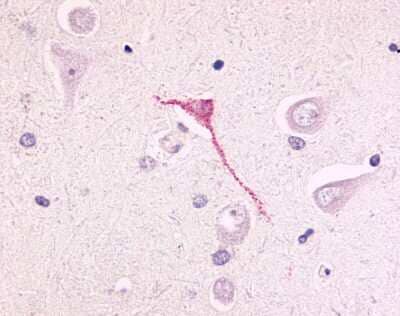 Immunohistochemistry-Paraffin: GPR17 Antibody [NLS4228] - IHC analysis of Brain, Neurons and glia using NLS4228 at 2 ug/ ml.