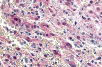 Immunohistochemistry-Paraffin GPR17 Antibody - BSA Free