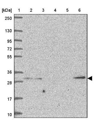 Western Blot: GPR171 Antibody [NBP2-32359] - Lane 1: Marker  [kDa] 250, 130, 95, 72, 55, 36, 28, 17, 10.  Lane 2: Human cell line RT-4.  Lane 3: Human cell line U-251MG sp.  Lane 4: Human plasma (IgG/HSA depleted).  Lane 5: Human liver tissue.  Lane 6: Human tonsil tissue