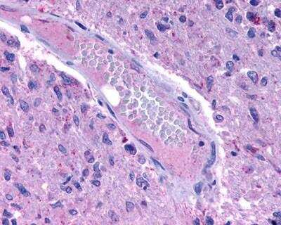 Immunohistochemistry-Paraffin: GPR175 Antibody [NLS1520] - Analysis of anti-TPRA1 / GPR175 antibody with heart.