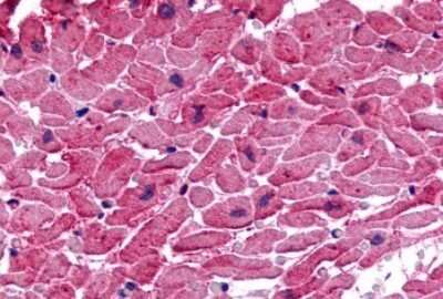 Immunohistochemistry-Paraffin: GPR175 Antibody [NLS1520] - Anti-TPRA1 / GPR175 antibody IHC of human heart. Immunohistochemistry of formalin-fixed, paraffin-embedded tissue after heat-induced antigen retrieval.