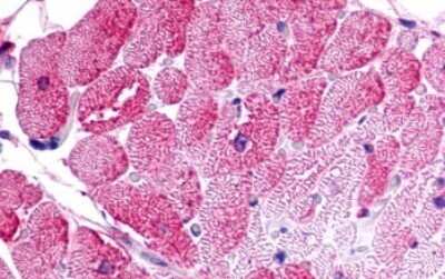 Immunohistochemistry-Paraffin: GPR175 Antibody [NLS1522] - Anti-TPRA1 / GPR175 antibody IHC of human heart. Immunohistochemistry of formalin-fixed, paraffin-embedded tissue after heat-induced antigen retrieval.