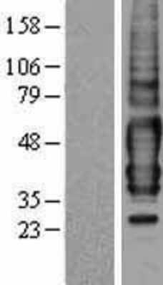 Western Blot: GPR175 Overexpression Lysate (Adult Normal) [NBP2-11080] Left-Empty vector transfected control cell lysate (HEK293 cell lysate); Right -Over-expression Lysate for GPR175.