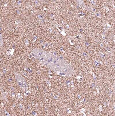 Immunohistochemistry-Paraffin: GPR176 Antibody [NBP1-81819] - Staining of human caudate nucleus shows moderate positivity in neuropil.