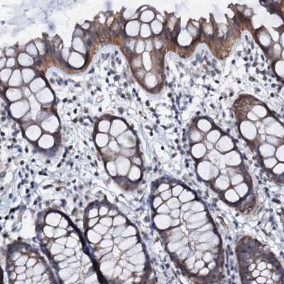 Immunohistochemistry-Paraffin GPR176 Antibody - BSA Free