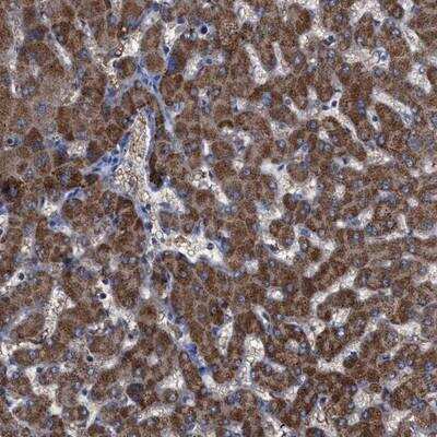 Immunohistochemistry-Paraffin GPR179 Antibody - BSA Free