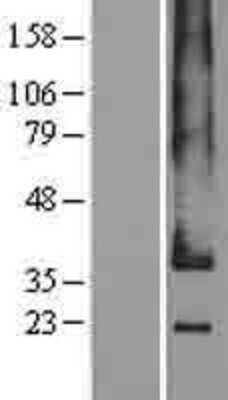 Western Blot Adrenomedullin R/ADMR/GPR182 Overexpression Lysate