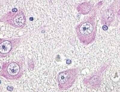 Immunohistochemistry: GPR19 Antibody [NLS97] - Staining of Human Brain, Neurons