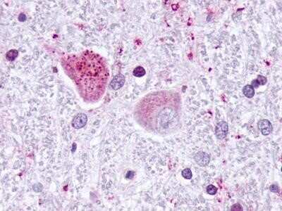 Immunohistochemistry-Paraffin: GPR19 Antibody [NLS97] - Staining of Human Brain, Neurons, and Glia