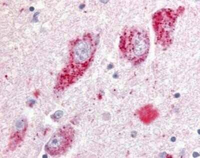 Immunohistochemistry-Paraffin GPR20 Antibody - BSA Free