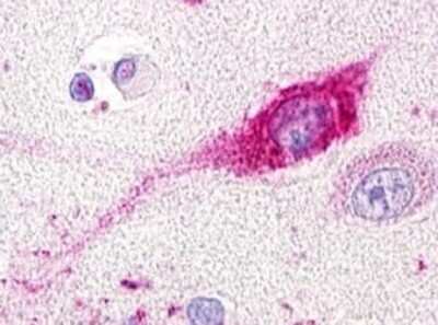 Immunohistochemistry-Paraffin GPR20 Antibody - BSA Free
