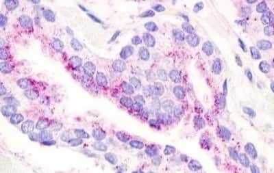 Immunohistochemistry-Paraffin: GPR21 Antibody [NBP3-14354] - Immunohistochemistry of formalin-fixed, paraffin-embedded human prostate after heat-induced antigen retrieval. Antibody dilution 1.9 ug/ml