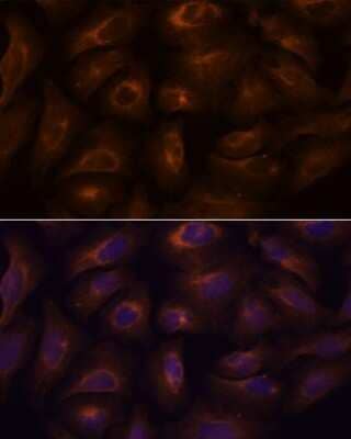 Immunocytochemistry/Immunofluorescence: GPR22 Antibody [NBP3-15567] - Immunofluorescence analysis of U-2 OS cells using GPR22 antibody (NBP3-15567) at dilution of 1:100. Blue: DAPI for nuclear staining.