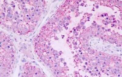 Immunohistochemistry-Paraffin: GPR22 Antibody [NBP1-02319] - Immunohistochemical analysis of formalin-fixed, paraffin-embedded human testis tissue.