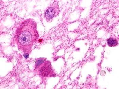 Immunohistochemistry-Paraffin: GPR25 Antibody [NLS378] - Analysis of anti-GPR25 antibody with human brain, hypothalamus at dilution 3-5 ug/ml.