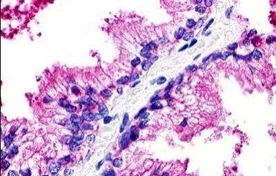 Immunohistochemistry-Paraffin: GPR25 Antibody [NLS483] - Analysis of anti-GPR25 antibody with human prostate.