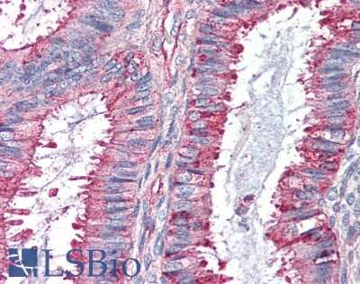 Immunohistochemistry-Paraffin: GPR27 Antibody - BSA Free [NBP2-29388] - Anti-GPR27 antibody IHC of human uterus. Immunohistochemistry of formalin-fixed, paraffin-embedded tissue after heat-induced antigen retrieval.