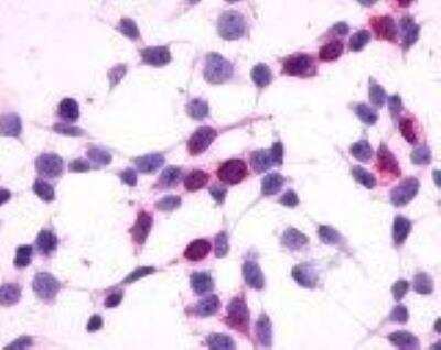 Immunocytochemistry: GPR27 Antibody [NLS496] - Staining of HEK293 human embryonic kidney cells transfected with GPR27.