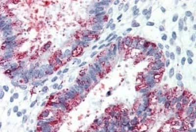 Immunohistochemistry-Paraffin: GPR27 Antibody [NBP3-14357] - Immunohistochemistry of formalin-fixed, paraffin-embedded human uterus after heat-induced antigen retrieval.