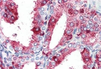 Immunohistochemistry-Paraffin: GPR27 Antibody [NBP3-14357] - Immunohistochemistry of formalin-fixed, paraffin-embedded human prostate after heat-induced antigen retrieval.