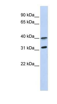 Western Blot: GPR27 Antibody [NBP1-62485] - MCF-7 whole cell lysates, concentration 0.2-1 ug/ml.