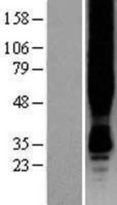 Western Blot: GPR30 Overexpression Lysate (Adult Normal) [NBP2-10979] Left-Empty vector transfected control cell lysate (HEK293 cell lysate); Right -Over-expression Lysate for GPR30.