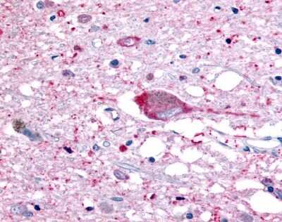 Immunohistochemistry-Paraffin: GPR32 Antibody [NLS4889] - Analysis of anti-GPR32 antibody with brain, neuron.