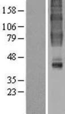 Western Blot: GPR32 Overexpression Lysate (Adult Normal) [NBL1-11274] Left-Empty vector transfected control cell lysate (HEK293 cell lysate); Right -Over-expression Lysate for GPR32.