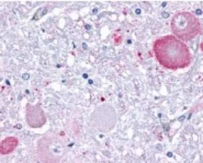 Immunohistochemistry-Paraffin: GPR34 Antibody [NLS1255] - Analysis of anti-GPR34 antibody with brain, neurons and glia at 1 ug/ ml.
