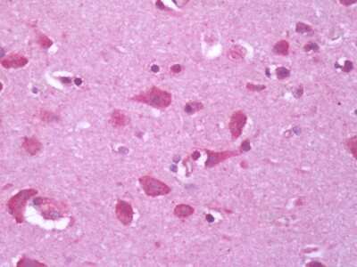 Immunohistochemistry-Paraffin: GPR34 Antibody [NLS1255] - Analysis of anti-GPR34 antibody with human brain, cortex.