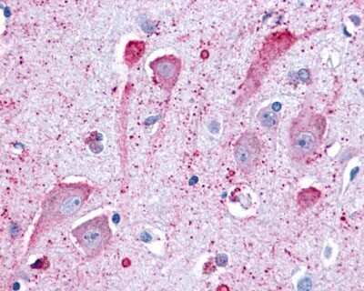 Immunohistochemistry-Paraffin: GPR34 Antibody [NLS1259] - Analysis of anti-GPR34 antibody with human brain, neurons and glia.