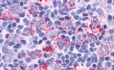 Immunohistochemistry-Paraffin: GPR34 Antibody [NLS1259] - Anti-GPR34 antibody IHC of human Lymph Node, Hodgkins Lymphoma. Immunohistochemistry of formalin-fixed, paraffin-embedded tissue after heat-induced antigen retrieval.